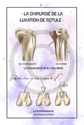 La luxation de rotule - Chirurgie