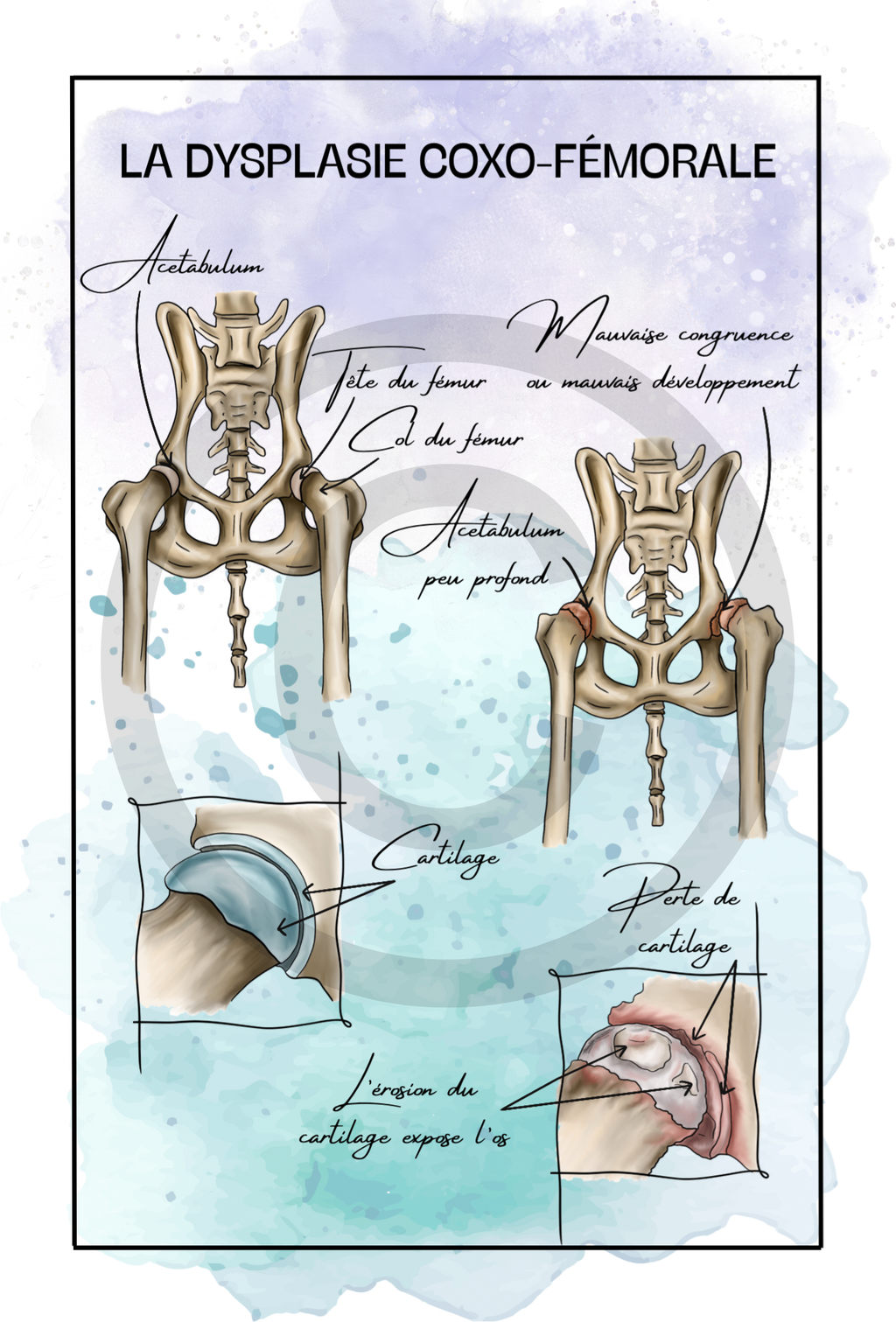 Pack Postérieur - 7 planches