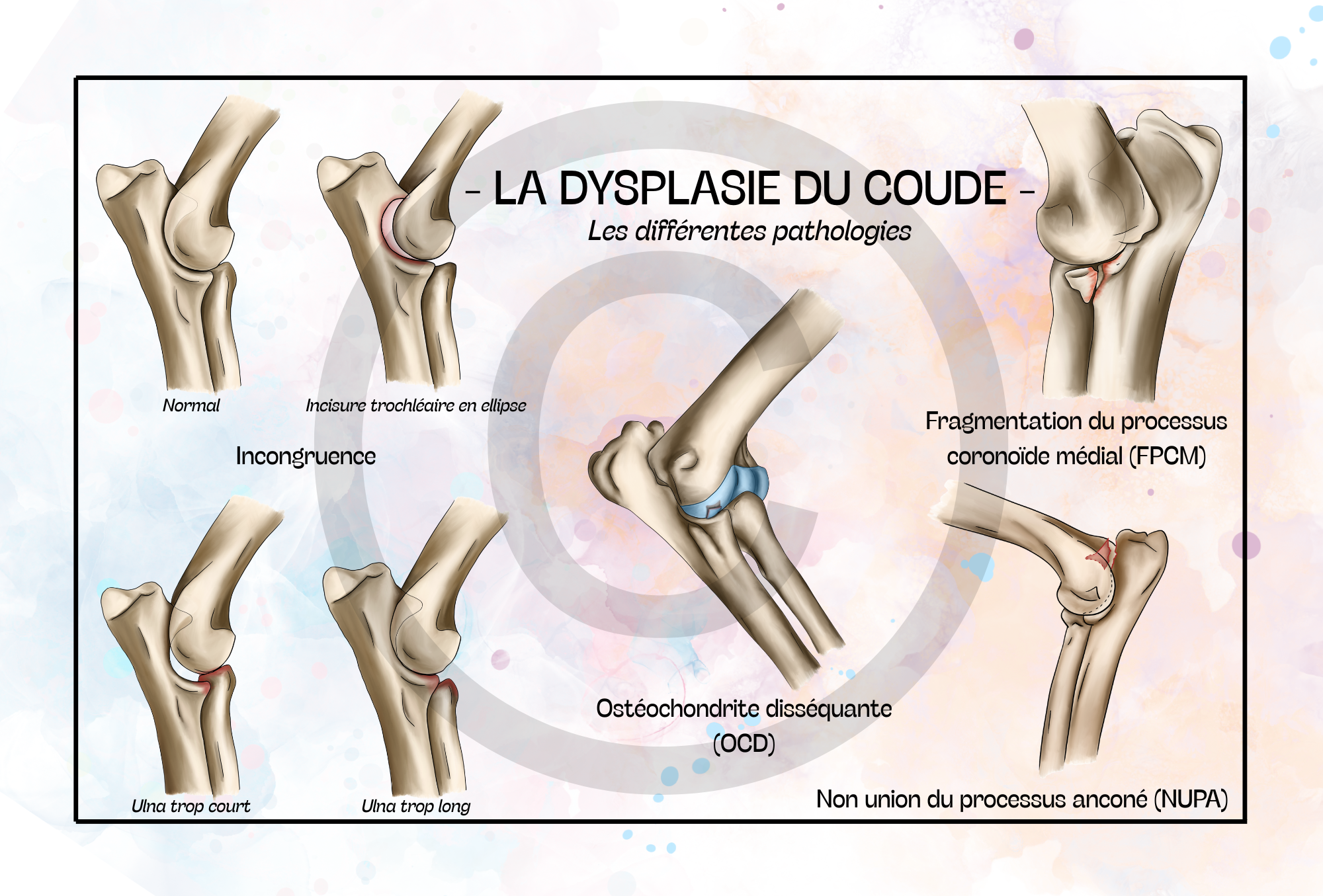 Pack Coude - 4 planches