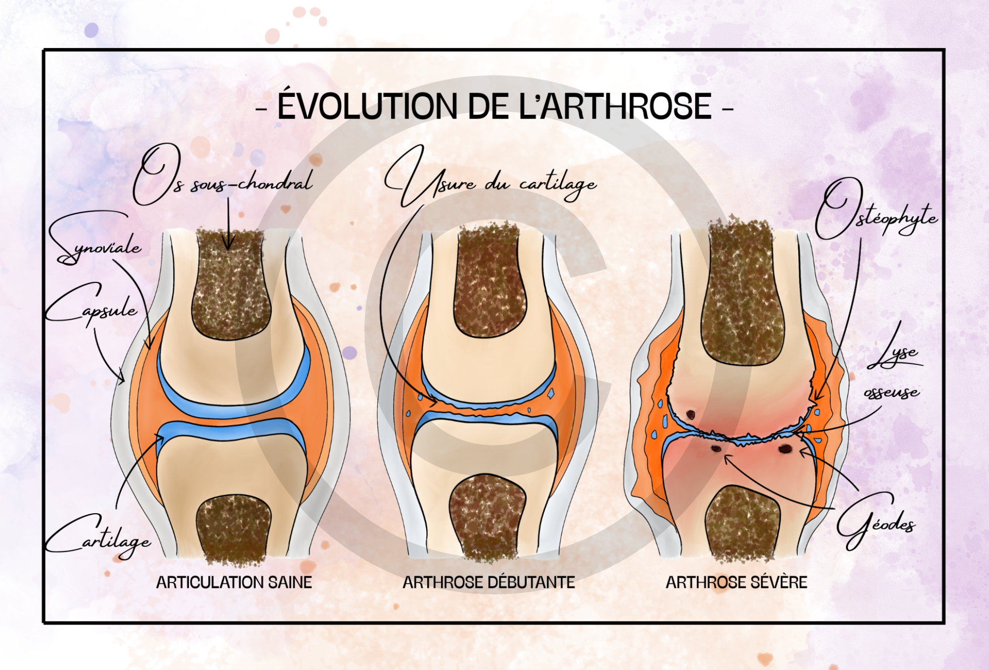Pack COMPLET - 19 planches