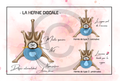 La hernie discale - Les types