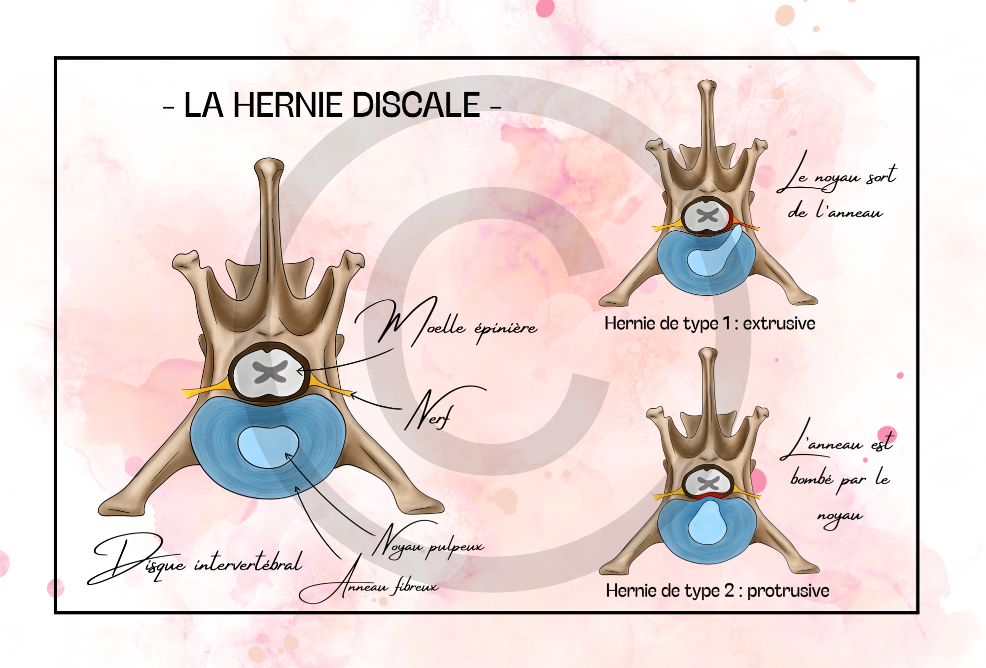 Pack COMPLET - 19 planches