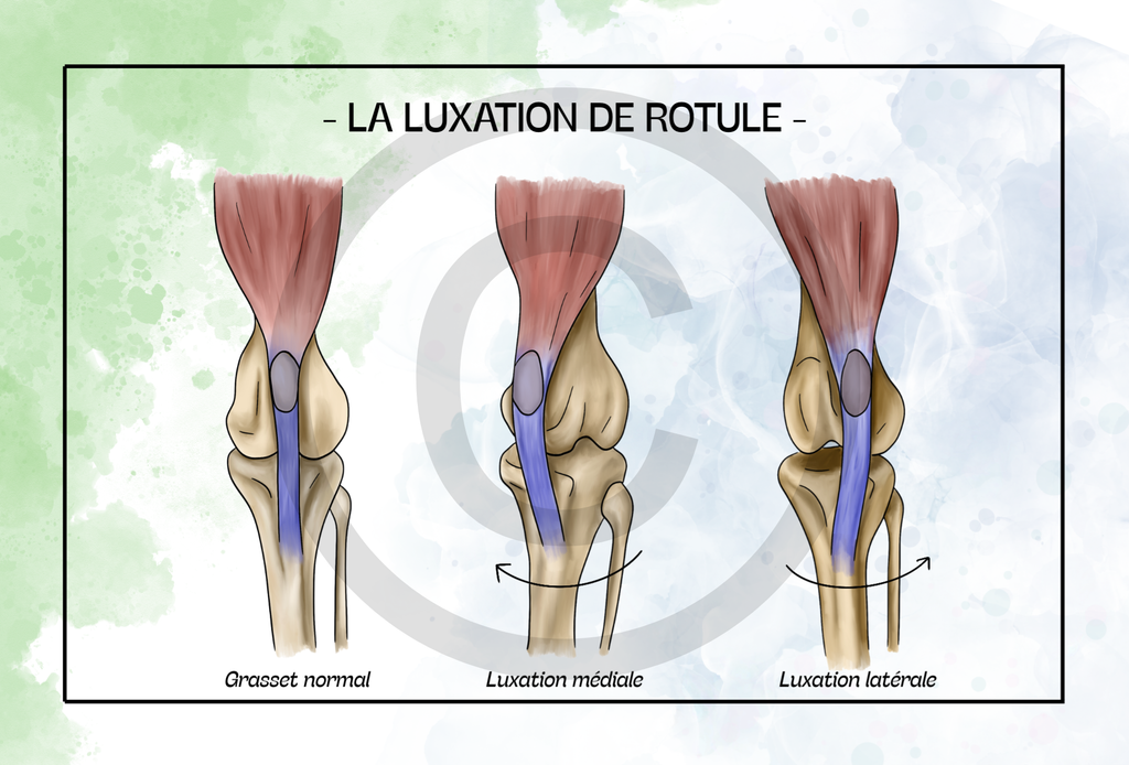 Pack Postérieur - 7 planches