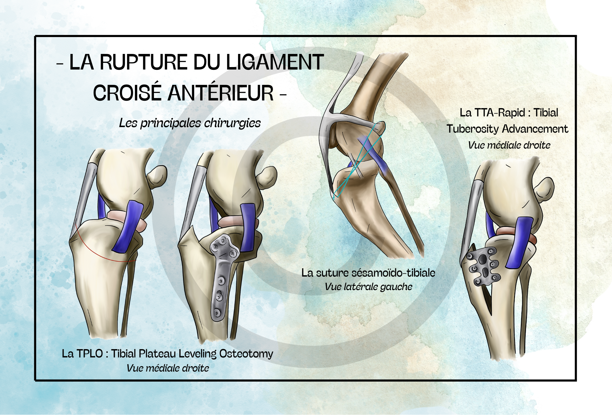 Pack COMPLET - 19 planches